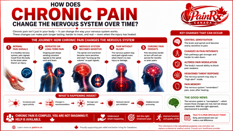 Educational infographic explaining how chronic pain changes the nervous system over time, showing the brain, spinal cord, and overactive pain pathways with the PainRx Canada logo. Designed for Canadian readers seeking information about chronic pain.